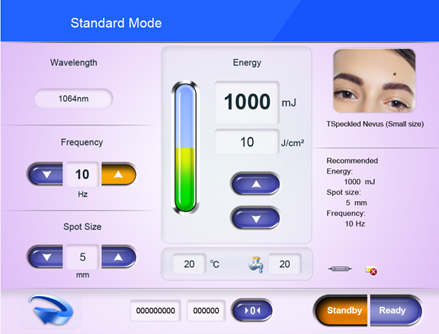 &Eacute;cran laser qs 2