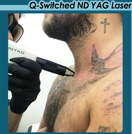 &Eacute;quipement laser qs 1