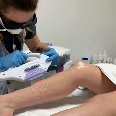 Combien coûte la coiffure au laser