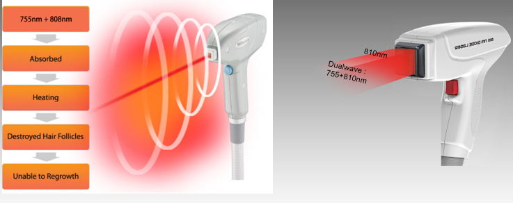 &eacute;quipement laser &agrave; diode