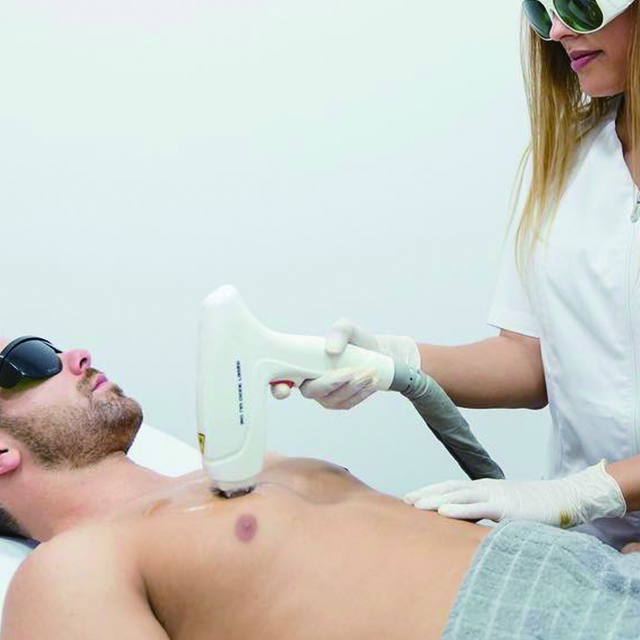 laser d'&eacute;pilation