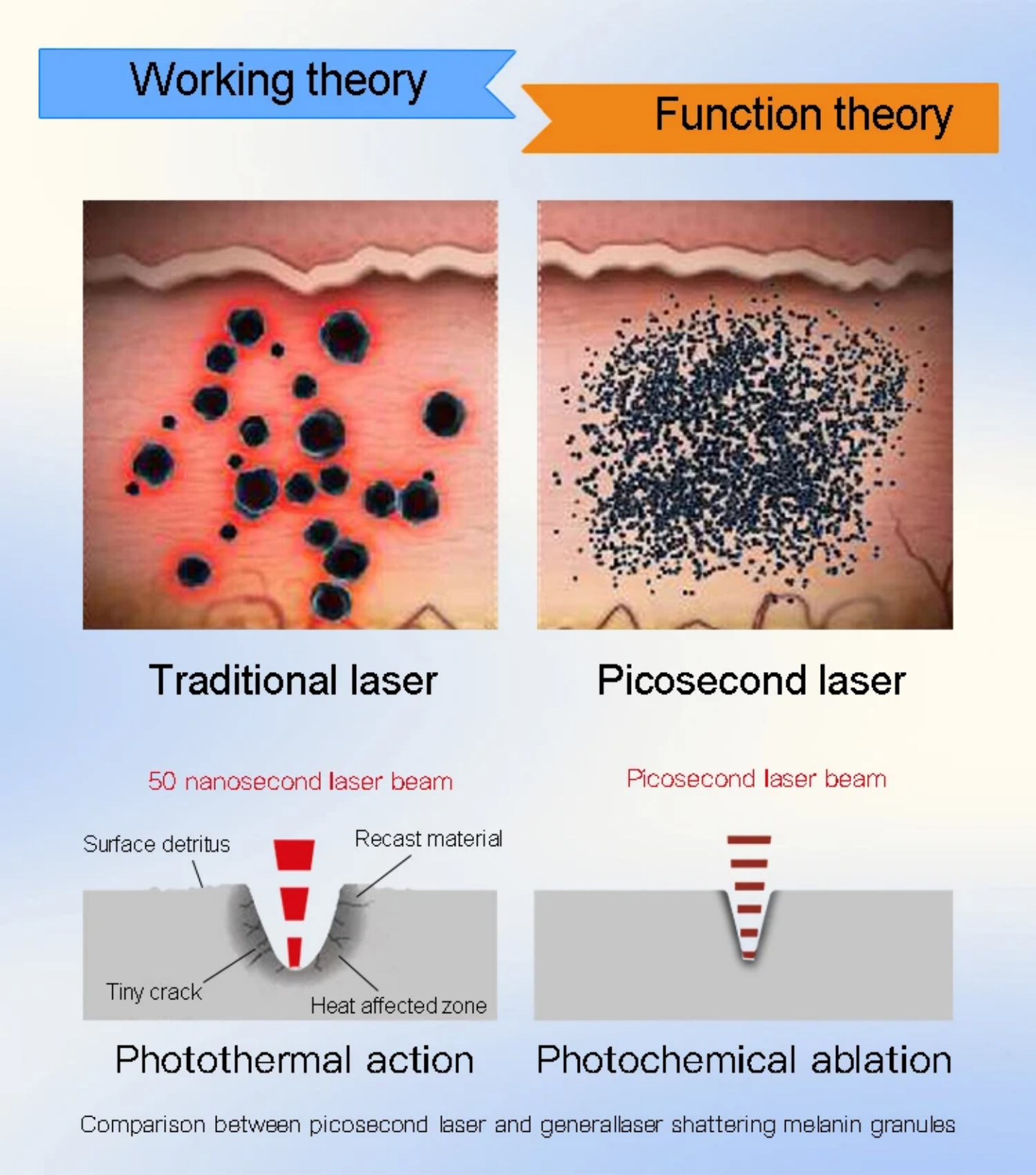 Quelle est la science derrière l'élimination du tatouage au laser?
