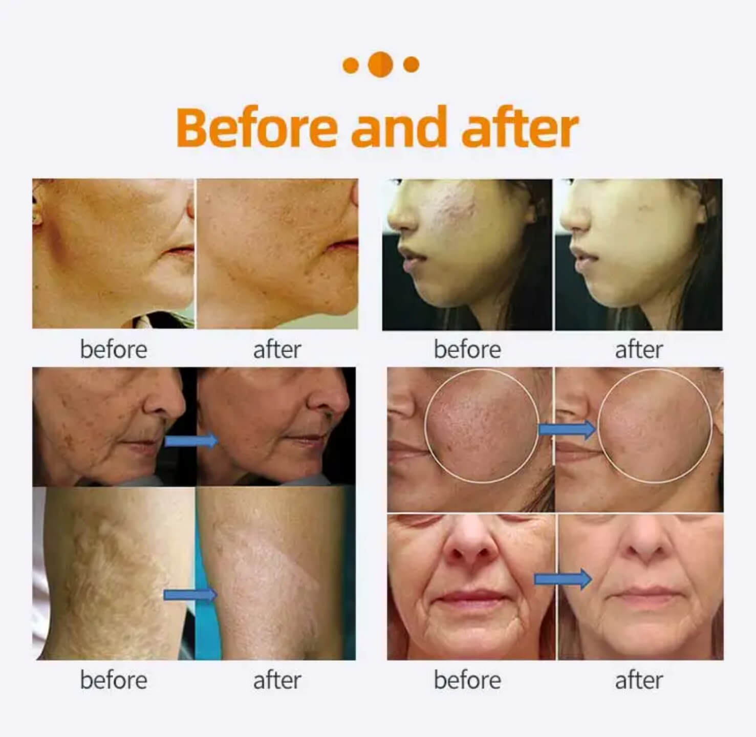 Avant et Apr&egrave;s