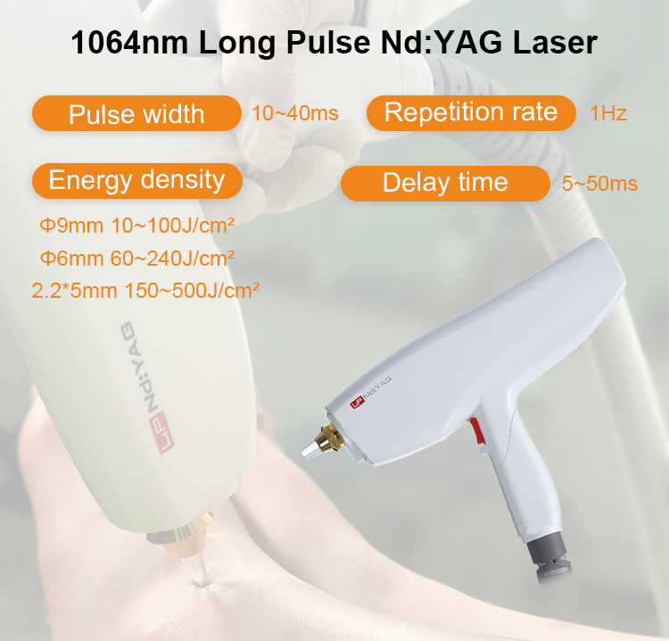 pi&egrave;ce &agrave; main laser &agrave; impulsion longue